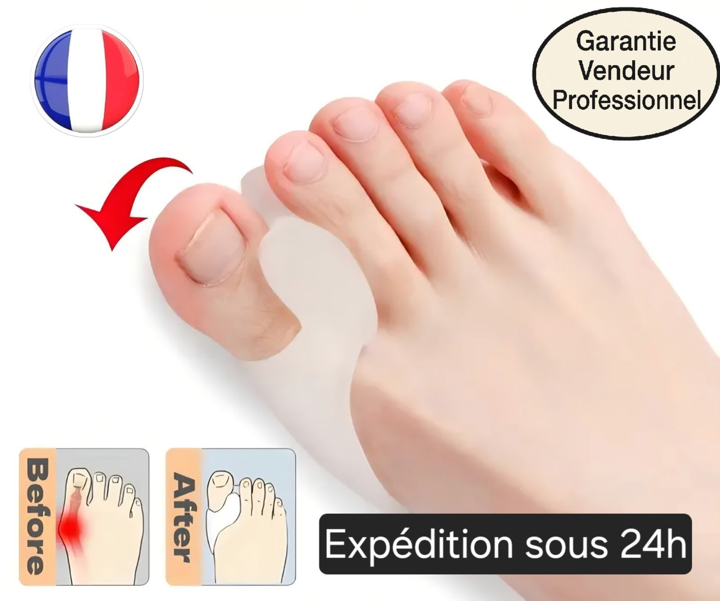 Orthèses Silicone Hallux Valgus – 2 Doigts | Anti-Oignons & Confort Pieds 🇫🇷