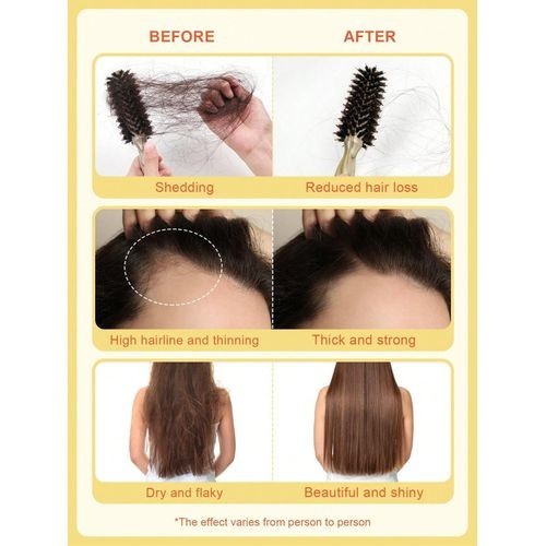 Sérum huile soins cheveux anti-perte des cheveux, croissance cheveux 15ml ginger