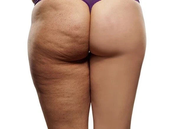 AROMA-ZONE Gel de soin Galbe & Silhouette - cellulite - Raffermissant & Lissant