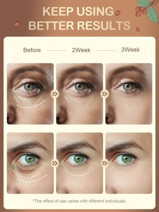 Contour des yeux gel pour les poches, cernes marrons, ridules, éclaircit 15ml