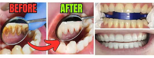 Dentifrice blanchissant les dents blanc Signal COCO visible en 3 jours 75ML 🇫🇷