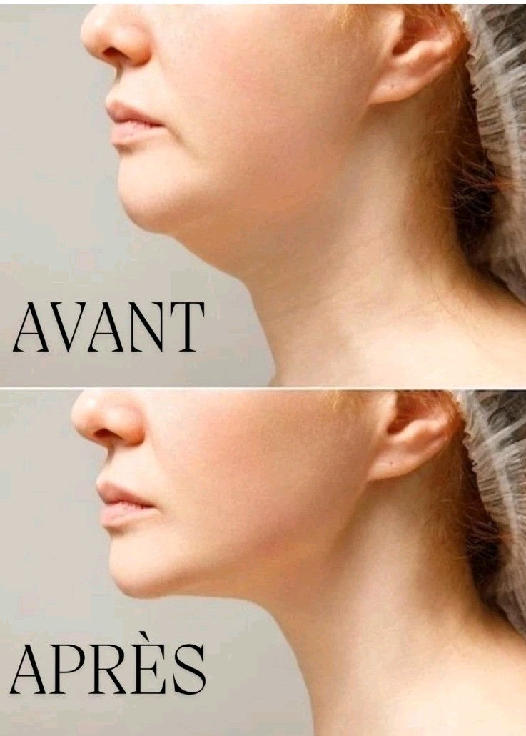 Gaine Anti Double Menton  | Masque Anti Double Menton | Lifting Mask Anti Age