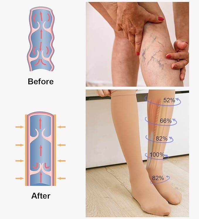 Taille S Chaussettes de Compression Contention contre les Varices fatigue jambes