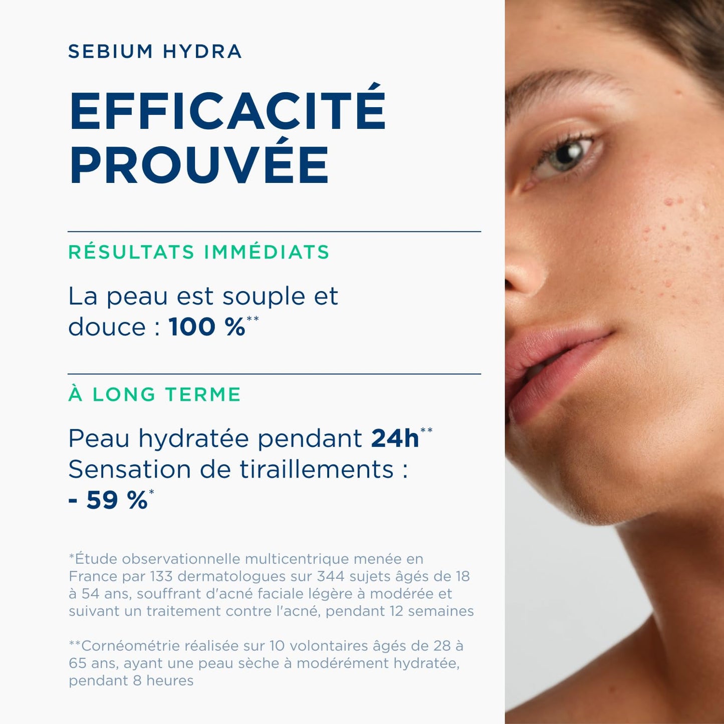 BIODERMA Sébium Mat Control Matifie/Lisse Transformation Durable 30 ml