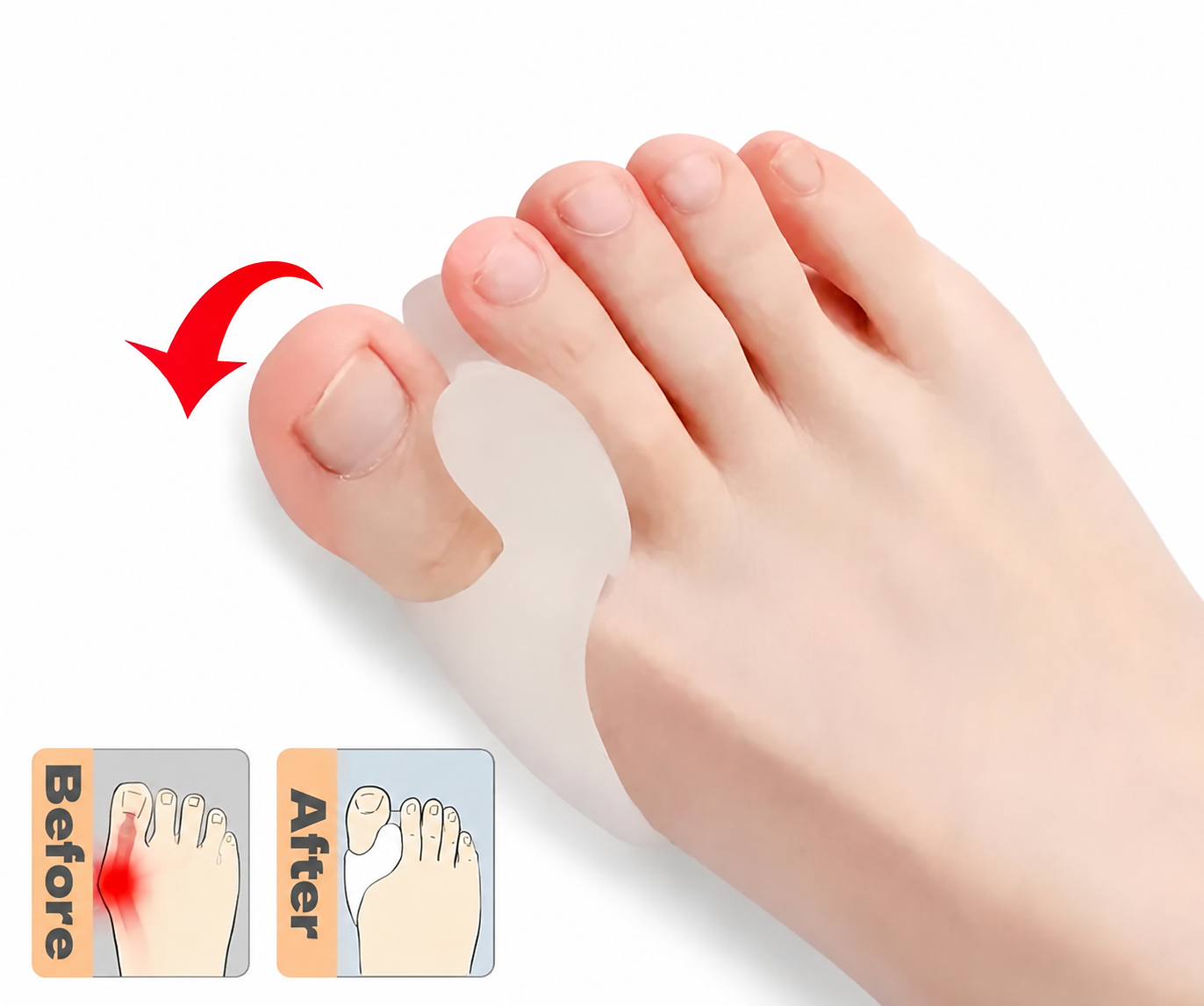 Ortesis de silicona para juanetes - 2 dedos | Antijuanetes y confort para los pies